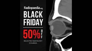 🔥50% OFF our latest courses 🔥 20% OFF All-Access Pass 