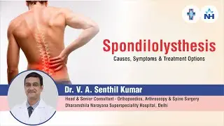 Spondylolisthesis - Causes, Symptoms and Treatment Options | Dr. V. A. Senthil Kumar