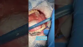 Этапы проведения профессиональной гигиены полости рта! 