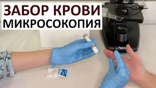 Забор крови и гемосканирование (рассмотрение под микроскопом)