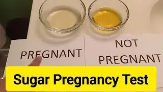 Sugar Pregnancy Test At Home || Pregnancy Test At Home || Malayalam