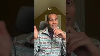 FUE hair transplant Turkey - 3 Months Update @cabhealth #turkeyhairtransplant #hairtransplant