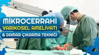 Mikrocerrahi Varikosel Ameliyatı & Damar Çıkarma Tekniği