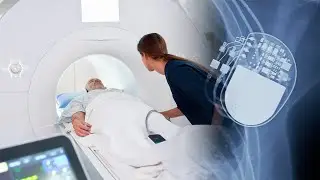 MRI for Patients with a Pacemaker