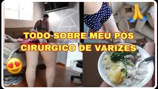 TUDO SOBRE O PÓS DA MINHA CIRURGIA DE VARIZES FEITA PELO SUS🙏+PRIMEIRO BANHO+TIREI OS CURATIVOS😱