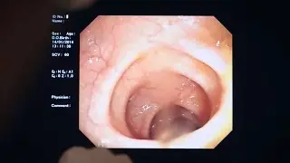 What's Inside Your Bowels? | Should I Eat Meat? | BBC Studios