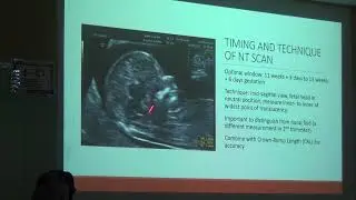 Dr. Maizun Ishak (O&G Hospital Ar-Ridzuan)