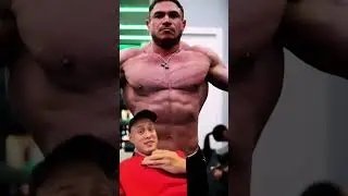 ПОКУСАЛИ ПЧЁЛЫ 🐝