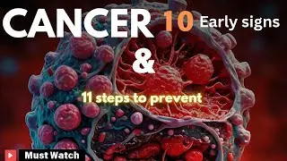 CANCER: 10 Warning signs and 11 Prevention steps