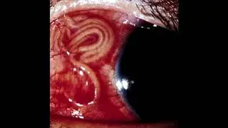 VITAL $IGNZ & BLOKKA $OLO - PARASITE EVE [Prod. GRIGORYAN & SID WHITE]