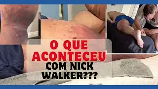 😨NICK WALKER FORA DO OLYMPIA⭕  (LESÃO) fim do sonho?