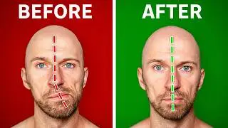 Fix Asymmetrical Jaw & Face (In Under 1 Minute a Day)