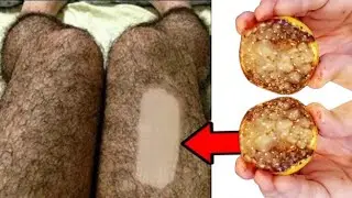 Stop shaving! Remove all unwanted hair with lemon peeling!