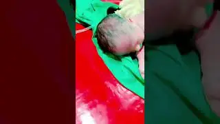 Newborn baby afterbirth