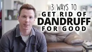 3 Ways to Get Rid of Dandruff For Good