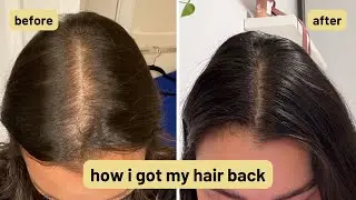 hair treatment for hair loss