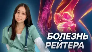 Болезнь Рейтера | Какие симптомы и осложнения | МедВуза