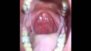 Me swallowing milk (2)