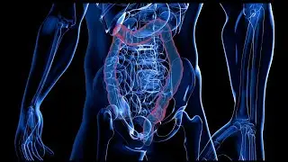 Preventing early-onset colorectal cancers, WashU researcher leads a team with a $25 million award
