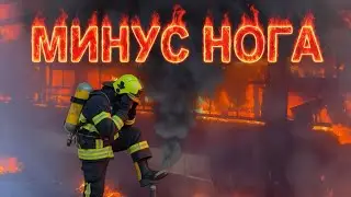Фуру сожгли, ногу сломали..