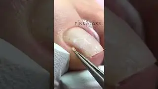 #pinkroyss