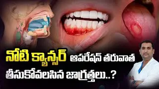 నోటి CANCER SURGERY తర్వాత ఎటువంటి జాగ్రత్తలు తీసుకోవాలి? | Dr.Avinash Chaitanya | Kaizen Hematology