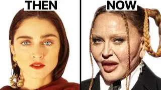 Madonna Plastic Surgeries - Surgeon Reacts