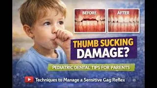 Does Thumb Sucking Damage Your Child's Teeth? A Dentist Explains