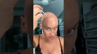 Sparkles for Leo season #bald #alopecia #hairloss #chl0ebean