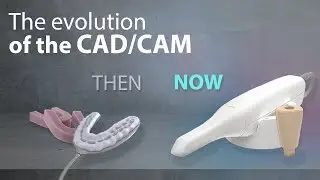 The evolution of dental impressions | CAD CAM | Digital dentistry | Uniqa Dental 2022