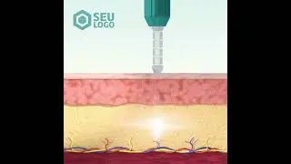 CANETA PRESSURIZADA