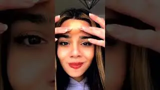 Black head removal on face - Blackheads on back treatment