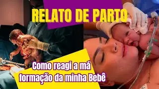 RELATO DE PARTO - FOI HUMANIZADO? COMO REAGI A MÁ FORMAÇÃO DA MÃO DA MINHA BEBÊ