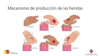 Clase 19 APH HERIDAS Y TRAUMA DE PARTES BLANDAS