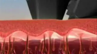 Depilacion Hombres Definitiva Laser ipl / Medellin  tel 5865705