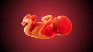 Foetus