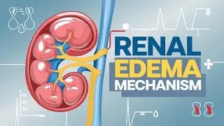 Mechanism of Renal Edema || General Pathology || Pathology  Past Papers || Robbins || Hemodynamics