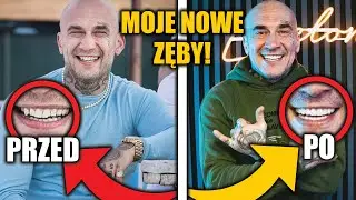Sobota - Hollywood Smile (Licówki i korony w Turcji)