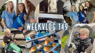 Extra groeiecho, babyshower & keuken laten wrappen! Weekvlog 149 | Carlijn Bras