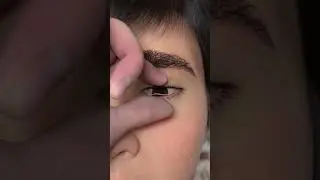Eyes' Worm Removal Animation PUYA ASMR