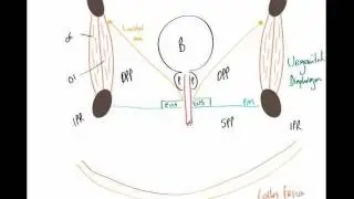 Perineal Pouches Part 2