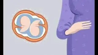 Эгизак фарзанд куриш  ва витаминлар