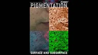 SURFACE AND SUBSURFACE  PIGMENTATION  #skincare #beauty #skinanalyzer