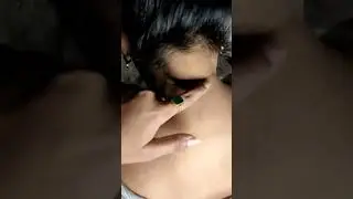 🥵Sun-Tan Remove Tips ll 