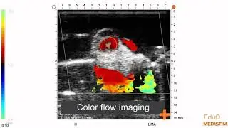 REQUEST Case 3: Ultrasound imaging of conduits