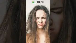 Can Hair Straightening Cause Hair Loss || ReDefine Channel || #hairfallsolution #shorts #ytshots