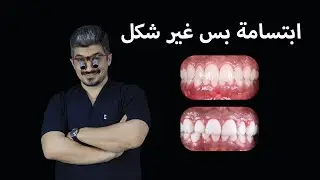 ابتسامة بس غير شكل