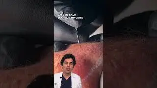 ACNE SCAR SINGLE SESSION Combination Treatment RESULTS 🙌 (TCA, Subcision, Lasers, Fillers)