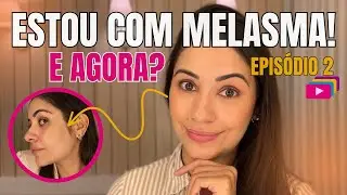Alterações Hormonais e Melasma: Minha Visita a Ginecologista - Saga do Melasma | Episódio 2