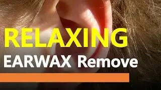[5 min] Relaxing Earwax Removal for sleep